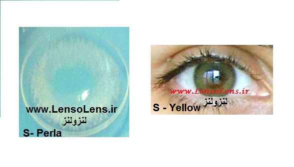 لنز طبی رنگی سولکو لنز طبی رنگی سولکو